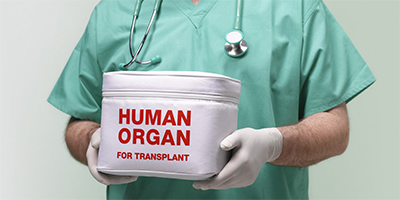 Department of Transplantation